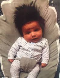 Episodes of gerd are painful, and they come with a variety of additional symptoms, such as explosive pain near the center of the chest and pain near oral cavity. Mailonline Readers Share Photos Of Their Very Hirsute Babies Daily Mail Online