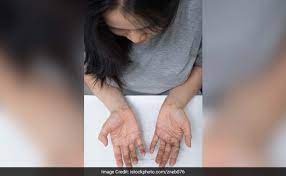 Signs of uterine fibroids include heavy bleeding, pelvic pressure, having to urinate a lot, back pain, and constipation or diarrhea. Hair Loss In Women May Indicate Increased Risk Of Fibroids