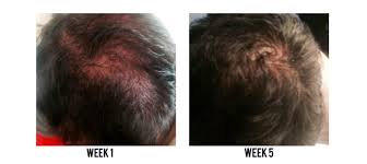 It gently cleanses and moisturizes with a formula that's full of moisturizing agents that's perfect for daily use. Hair Thickening Shampoo The Beauty Lounge