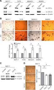Le système qualité des agences domusvi aide et soins à domicile comporte plusieurs moyens de contrôle de la qualité des prestations. Capicua Restricts Cancer Stem Cell Like Properties In Breast Cancer Cells Oncogene