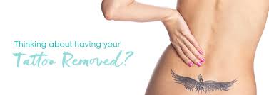 They are all you can ask for and the prices start from 100 ron depending on the complexity of you future tattoo :) cambridge, united. Miami Laser Tattoo Removal Cost Info Arviv Medical Aesthetics
