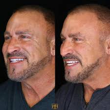 SMILE TEXAS•Dr. Rick L Kline