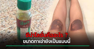 Join facebook to connect with cems cak and others you may know. D46cujz435lxvm