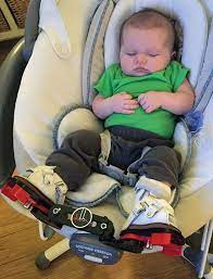 Clubfoot is one of the most common congenital deformities. Predicting Recurrence After Clubfoot Treatment Lower Extremity Review Magazine