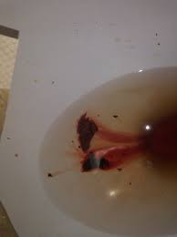 We did not find results for: Bleeding During Pregnancy Miscarriage Strange Piece Of Meat Came Out Of My V O O 1st Miscarriage Babycenter