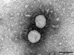Jun 28, 2021 · ラムダ型にはこれまでにない変異が細胞との接続部分にあり、 既存のワクチンの効果が弱くなる可能性がある ラムダ型は490番目のまったく違う新しいところに変異が入っている。 3倍から4倍、ないしは5倍くらいワクチンの有効性が下がる Gkajr1zszz0jjm