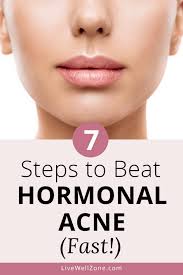 Testosterone is mainly responsible for hormonal acne. How To Get Rid Of Hormonal Acne Naturally Fast A 7 Step Plan For Skin