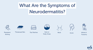 Image result for Neurodermatitis