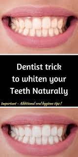 Pin On Teeth Whitening