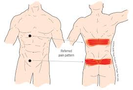 Stiff ql muscles, along with stiff hip flexors(psoas), could compress the discs and contribute to joint and disc pain in the lower back. Treat Muscle Knots In Lower Back Tiger Tail Usa