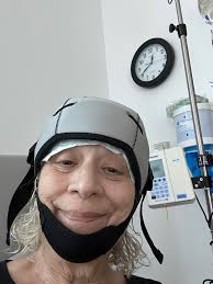 I just finished my 12th and final Taxol w/ Herceptin treatment and am so  happy to say that I hardly lost any hair at all using the DigniCap  scalp-cooling system. My nurses