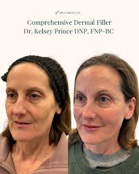 Kelsey Prince DNP, FNP-BC