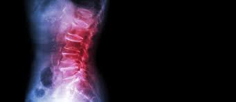 Ct scans are more common and less expensive, but mri. The Differences Between X Ray Mri Ct Scans For Spine Pain