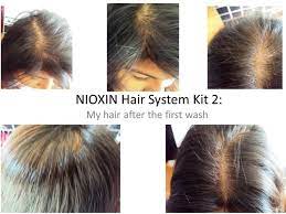 Here is detailed review of the, shampoo, systems, scalp treatment therapy, before and after pictures, side effects and it compares with other hair care products. Nioxin Nioxin Hair System Kit 2 Noticeably Thinning Hair Review Beauty Bulletin Treatments Masks
