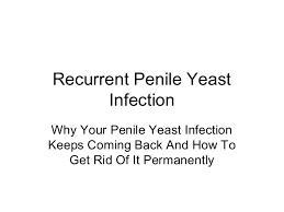 We did not find results for: Recurrent Penile Yeast Infection