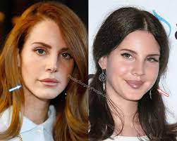 Lana del rey plastic surgery gets evident many times because she appears as a very different person now and you just can't avoid to note the changes that . Lana Del Rey Before And After 2019