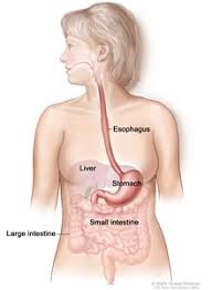 Stomach cancer, also known as gastric cancer, is a cancer that develops from the lining of the stomach. Gastric Cancer Treatment Pdq Treatment Patient Information Nci Cs Mott Children S Hospital Michigan Medicine