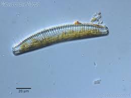 Image result for Entada bacillaris