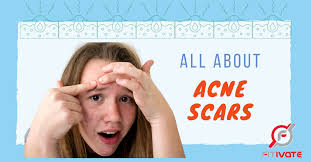 We did not find results for: Types Of Acne Scars And Treatment Fitivate