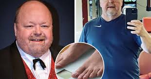 He is a member of the folk group orsa spelmän and benny anderssons orkester, founded by former abba member benny andersson. Kalle Moraeus Rasar I Vikt Efter Nya Satsningen Visar Stolt Upp Stora Kroppsforvandlingen