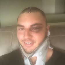 Ryan Esser (@ryanallenesser) • Instagram photos and videos