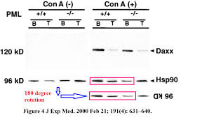 A lump in the breast can be a sign of breast cancer, but other changes in the breast can also signify this condition. The Wizard Men Curing Breast Cancer For Better Science
