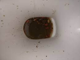 What does it mean when i have undigested food in my poop? Warning Gross Poop Pic What Is Wrong With My Bowels Mumsnet