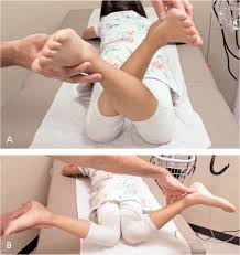 One of the reasons is often knock knocked knees is a slight deformity in children that happens when the legs of the baby are weak and. Lower Extremity Abnormalities In Children American Family Physician