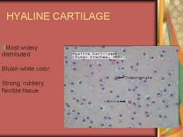 It is also most commonly found in the ribs, nose, larynx, and trachea. Specialized Connective Tissue Rigid Elastic Resilient Rebounds Readilyelastic