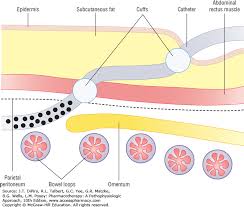 Hemodialysis And Peritoneal Dialysis Pharmacotherapy A