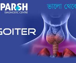 Image result for Thyroid Function Test