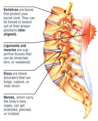 But sometimes back pain can be related to a disc that bulges or ruptures. Twerking Can Cause Low Back Pain Temple Terrace Fl Patch