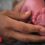 French babies: Missing limb births