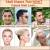 Male Types Of Hair Fall