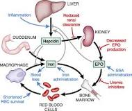 Image result for icd 10 code for anemia with ckd