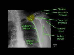 Y View Shoulder Mp4 Radiology Nursing Radiology Schools Anatomy