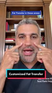 Fat Transfer for balancing and taking care of loss of volume #facialvolume  #balancingtheface #antiaging #beforeandafter #facialtreatment