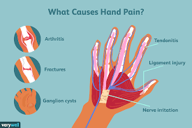 Hand Pain Causes Treatment And When To See A Doctor