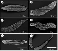 Image result for Diaphananthe vesicata