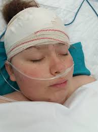 After 8 hours in surgery kacey is now AVM free and recovering in I.C.U all  went well thank you for all your support