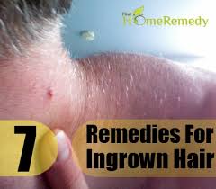Since the most common cause of ingrown hairs is cutting or removal of the hair below the level of the follicular orifice (commonly called a pore by patients), it typically tends to occur on your face, neck, armpits, groin, and legs. Ingrown Hair Home Remedies Natural Treatments And Cure Find Home Remedy Supplements
