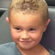 Boy, 6, mocked for his 'elf ears' has life transformed by cosmetic surgery 