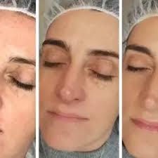 Schönheitssalon, Beautysalon Rheinfelden (Aargau)