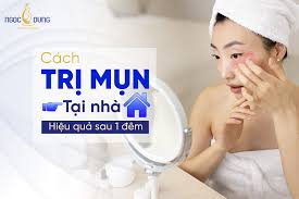 Mách bạn 27 cách trị mụn tại nhà hiệu quả sau 1 đêm, ít tốn kém