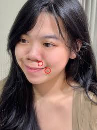 I've tried so many acne patches, but this one truly stands out. The  @Snow2plus_official @Snow2plus_global One Night Patch Plus uses real  science — magnesium microneedles — to calm breakouts fast. ✓ Feels