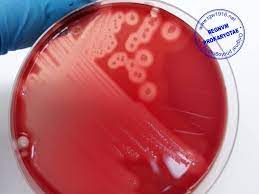 Principles and explanation of the procedure Abis Online Clostridium Perfringens Isolated From Sheep Facebook