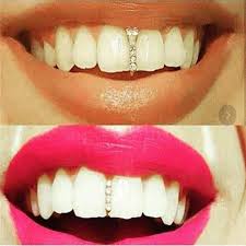 Women tend to favor bottom grillz more than. Punk Single Tooth Cap Teeth Grillz Top Creative Accessories Women Gold Teeth Caps Hip Hop Buy At A Low Prices On Joom E Commerce Platform