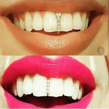 For a woman they looked feminine and they look good. Punk Single Tooth Cap Teeth Grillz Top Creative Accessories Women Gold Teeth Caps Hip Hop Buy At A Low Prices On Joom E Commerce Platform