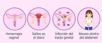 Fertilidad Despues Del Aborto Es Posible El Embarazo