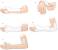 Short Arm Thumb Spica Cast